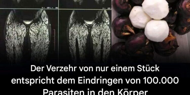 Jeden Tag konsumieren wir scheinbar harmlose Nahrungsmittel, die in Wirklichkeit jedoch potenziell gefährliche mikroskopische Parasiten beherbergen können.