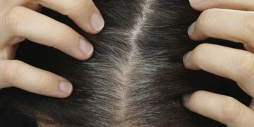 Grauen Haaren? Unglaublich, was ein paar Kartoffelschalen können!