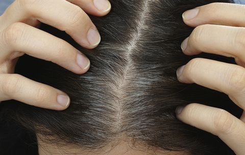 Grauen Haaren? Unglaublich, was ein paar Kartoffelschalen können!