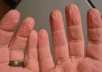 Diese 8 Körperreaktionen deuten viele Menschen völlig falsch. Es steckt nur ein Grund dahinter.