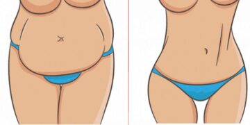 Schnell 10 Kg abnehmen: In 2 Wochen zum Traumgewicht?